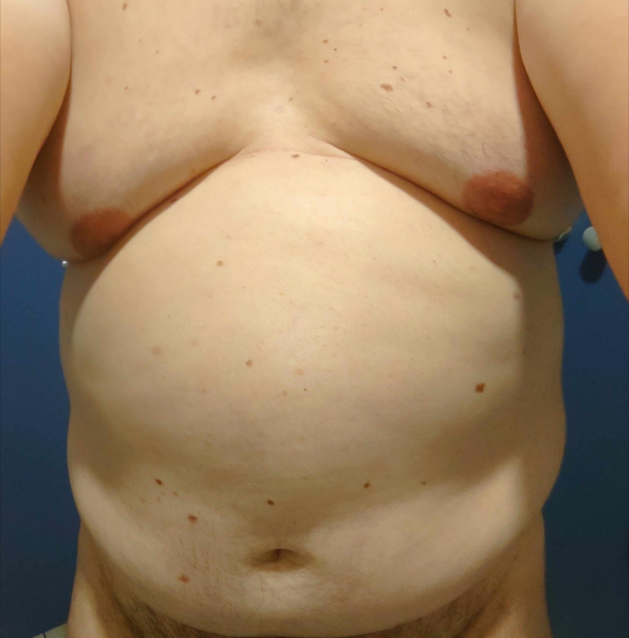 Profil de Mathyss, 51 ans, Escort Trans Belgique à Rijkevorsel